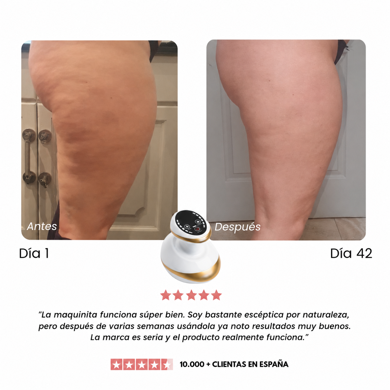 CelluMove™ - Masajeador
