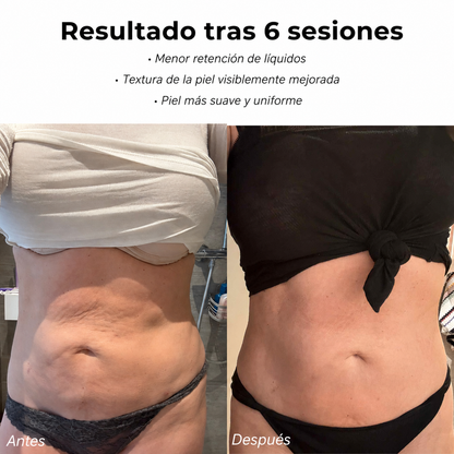 CelluMove™ - Masajeador